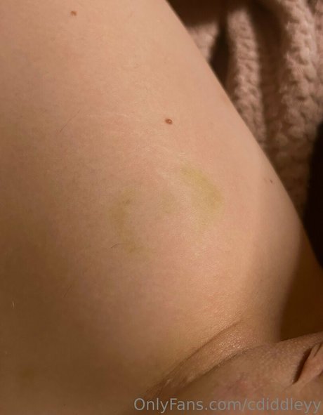 Cdiddleyy