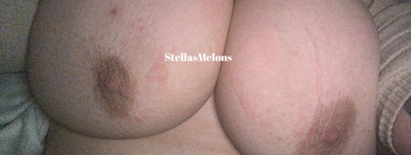 Stellasmelons