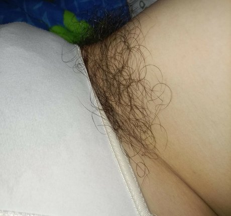 Hairy Women