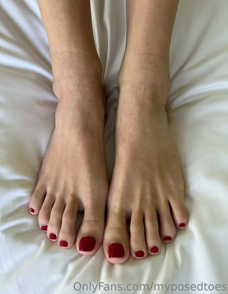 Myposedtoes