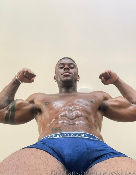 Prettyskinboi