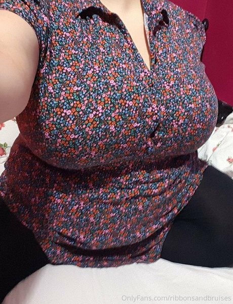 Ribbonsandbruises